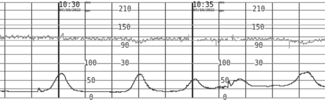 80_SURVELLAINCE_Tracings