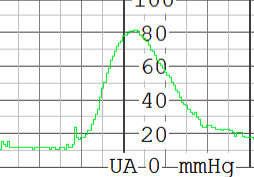 80_EHR_ASI_UA Tool