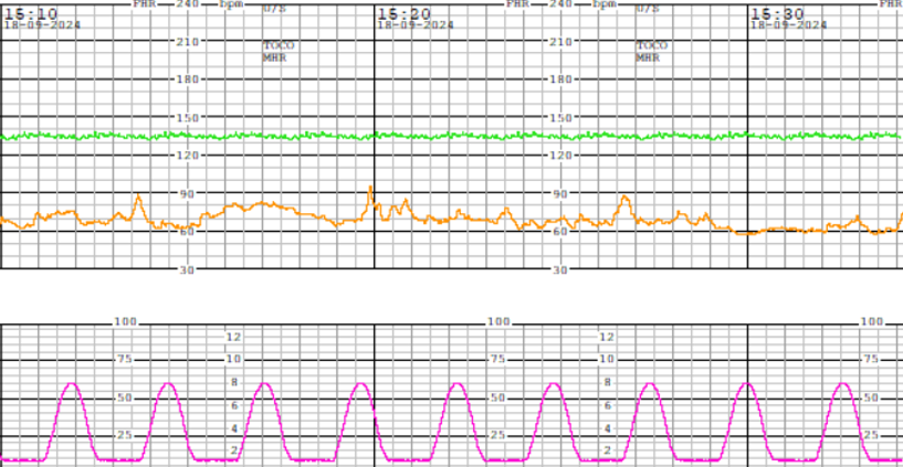 9Int_Tracings