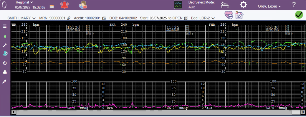 OBIX_WEB_E-Tools_Upgrade TEST